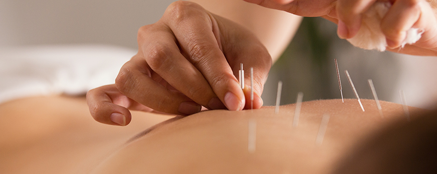 Acupuncturist Vienna