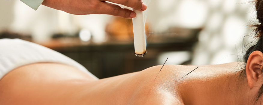 Moxibustion Vienna