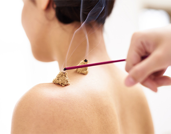 Bursitis Shoulder McLean