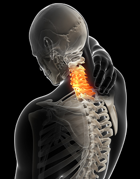 Neck Pain Treatment McLean
