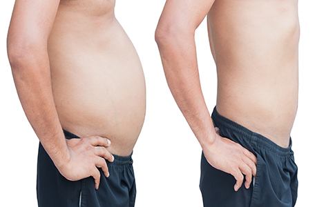 Weight Management McLean
